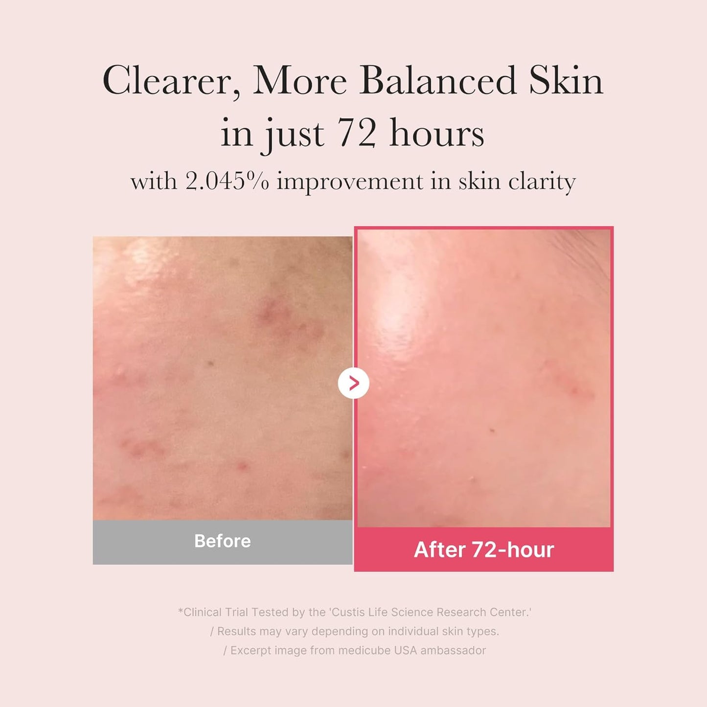 TXA+Niacinamide 15% Glow Facial Serum