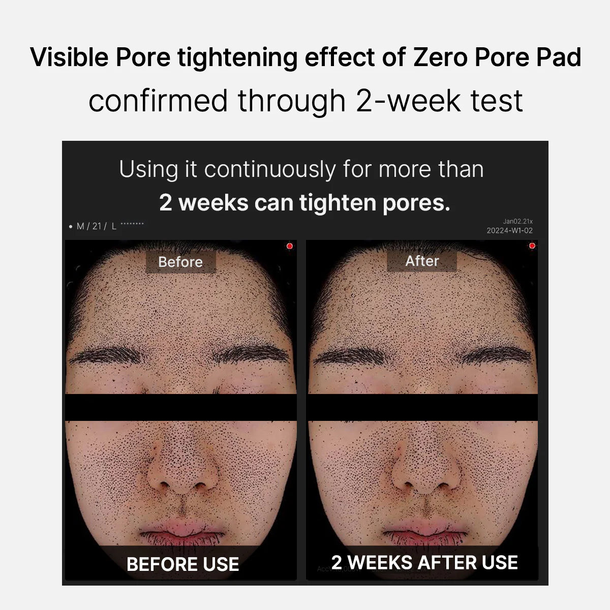 Zero Pore Pad 2.0