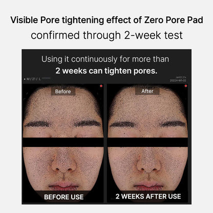 Zero Pore Pad 2.0