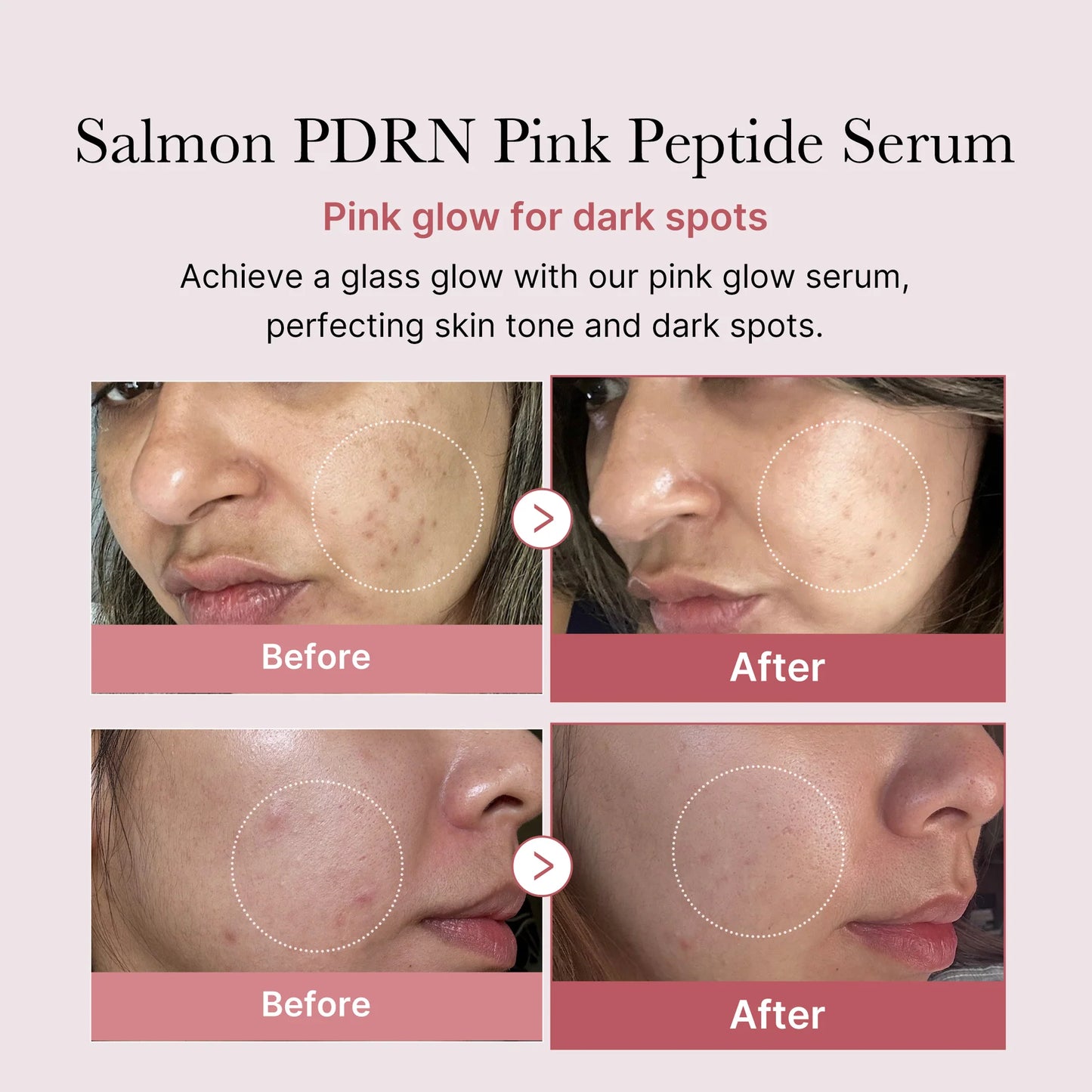 PDRN Pink Peptide Glow Serum 30ML