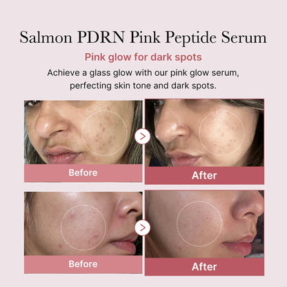 PDRN Pink Peptide Glow Serum 30ML