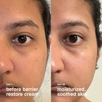 Barrier Restore Cream Comforting Daily Moisturizer 50ML